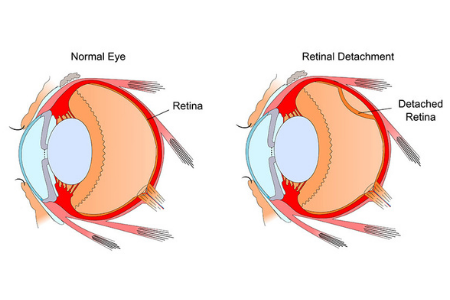 https://idealeyeclinic.com/wp-content/uploads/2022/03/idealeyey-1-1.png